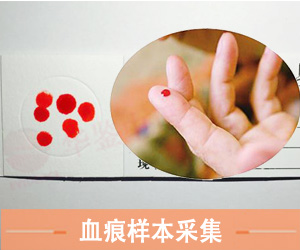 淄博血痕样本采集方法