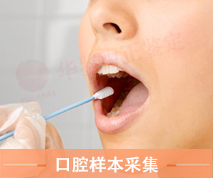 淄博口腔拭子采集方法