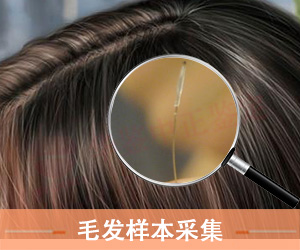 淄博毛发样本采集方法