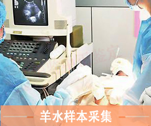 淄博羊水样本采样方法
