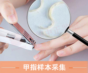 淄博指甲样本采集方法
